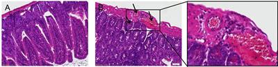 Immune Cell Responses and Cytokine Profile in Intestines of Mice Infected with Trichinella spiralis